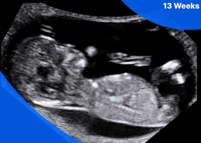 13 weeks baby